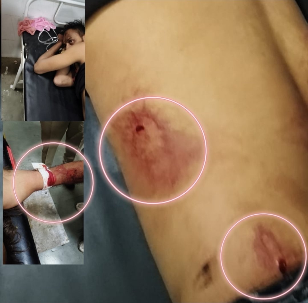 नलखेड़ा: दाल तड़का में नहीं था तड़का, भड़क गया विवाद… ढाबे पर चली लाठियां और चाकू!पुलिस ने किया प्रकरण दर्ज